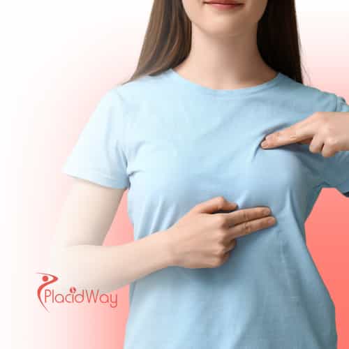 Affordable Breast Augmentation in Colombia: A Top Choice for Jamaican Patients